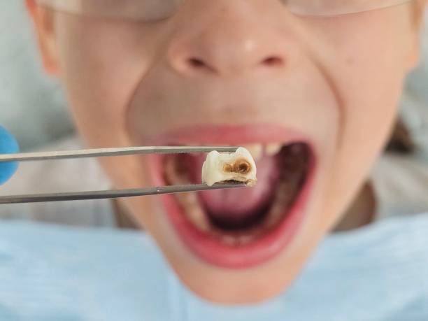 Best Emergency Pediatric Dental Care in Williamsport, MD